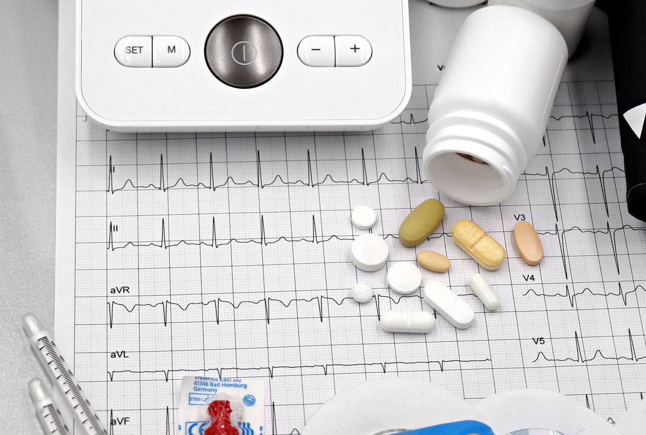 EKG a monitoring